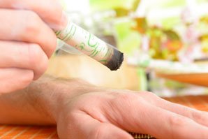 Moxibustion