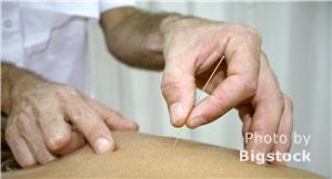 Traditional Chinese acupuncture and moxibustion are offered at the spa