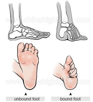 foot binding process